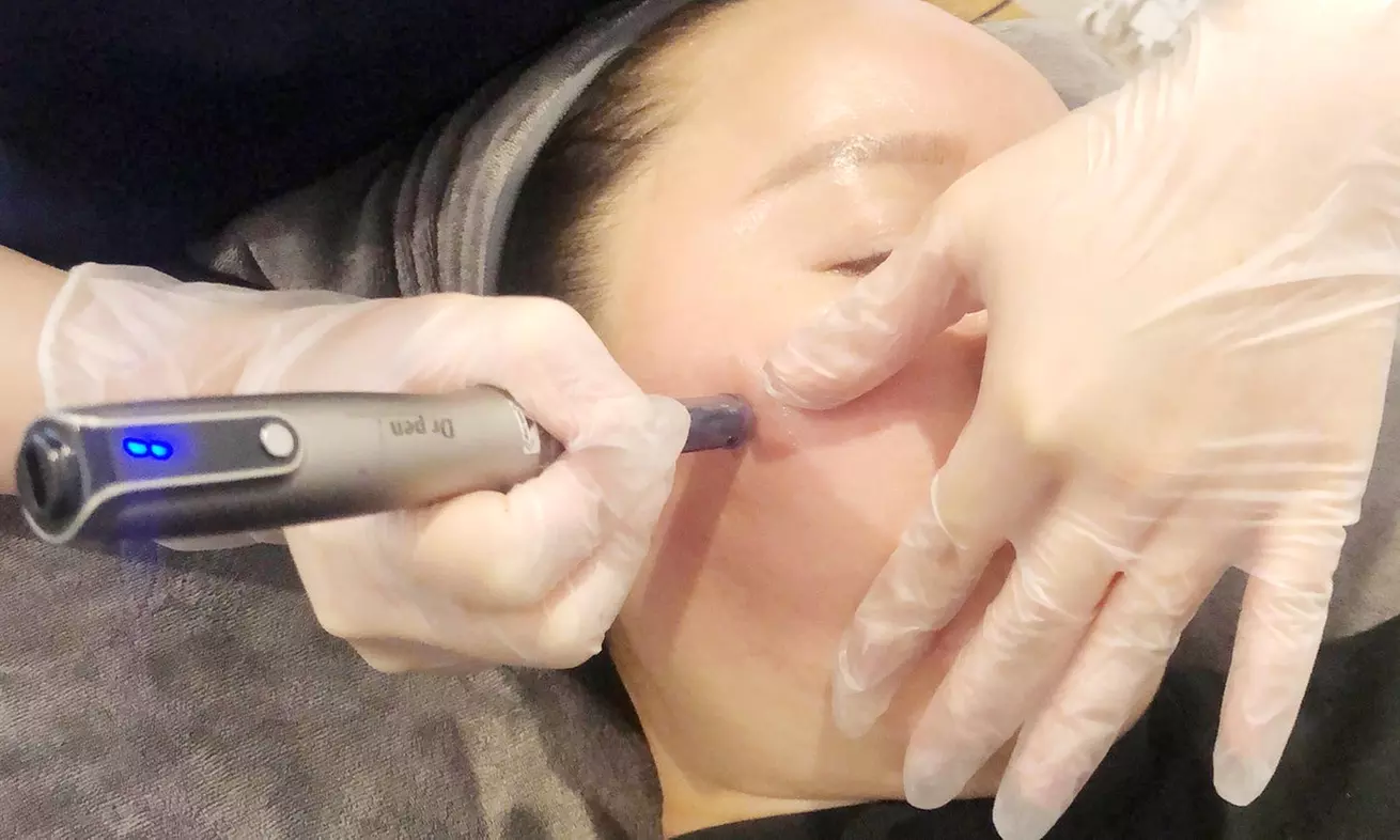 Glow Up with a 60-Min Microdermabrasion & Hydrating Facial, 90-Min Facial & Back Massage, or Micro-Needling