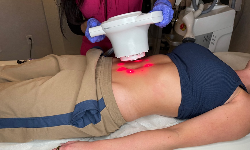 Image 1: Transform Your Body: 3 or 6 Laser Lipo Sessions at Euphoria Aesthetics