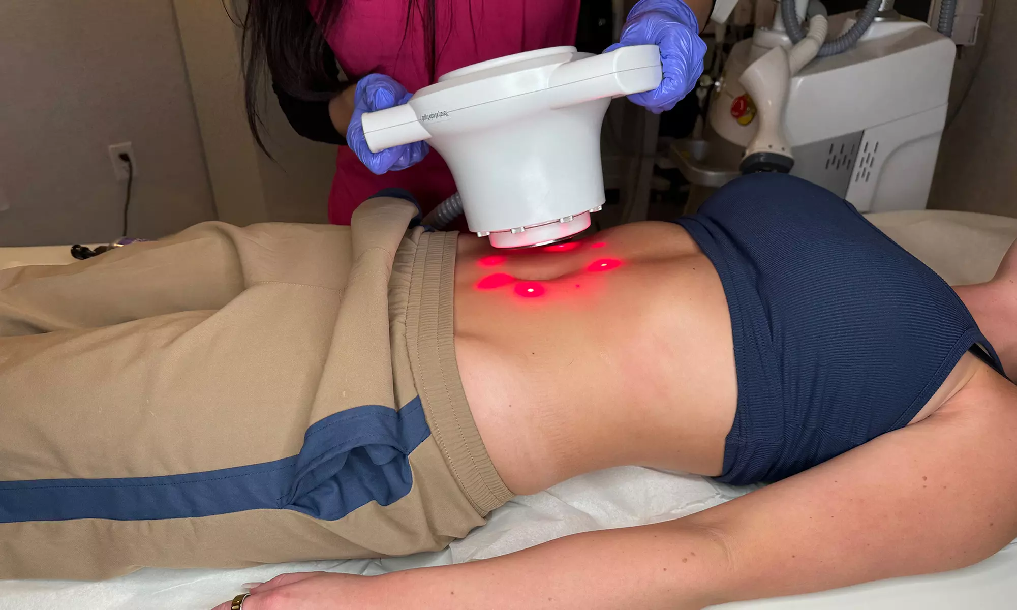 Transform Your Body: 3 or 6 Laser Lipo Sessions at Euphoria Aesthetics