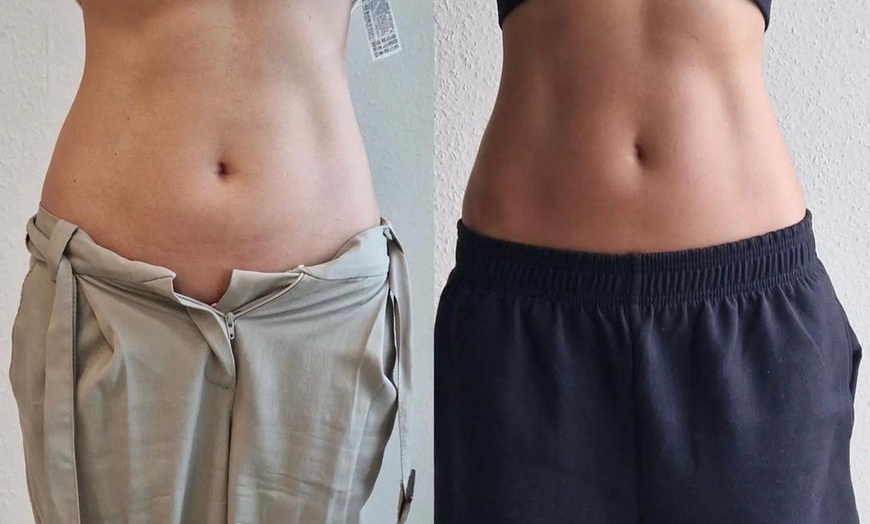 Image 1: Bis zu 42% Rabatt auf den EMS (elektrische Muskelstimulation) bei Esthétique de paris