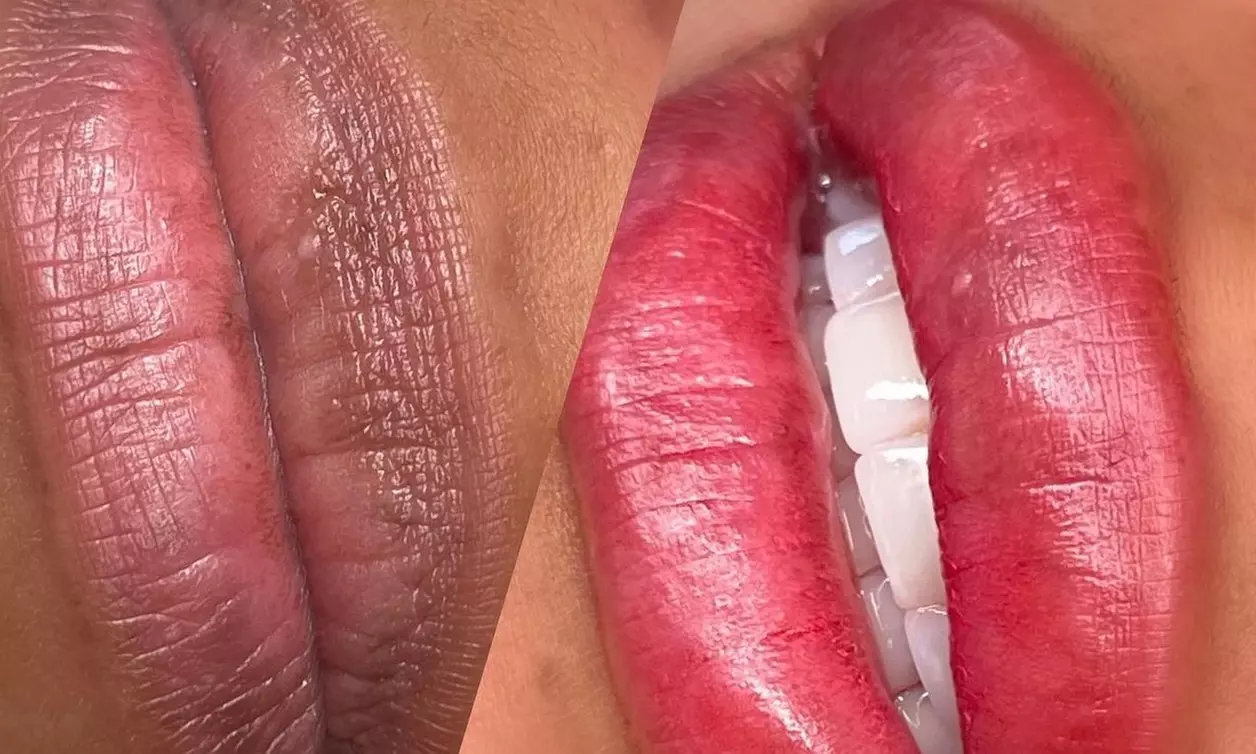 Lip Blushing or Dark Lip Magic Sessions with One Virtual Consultation