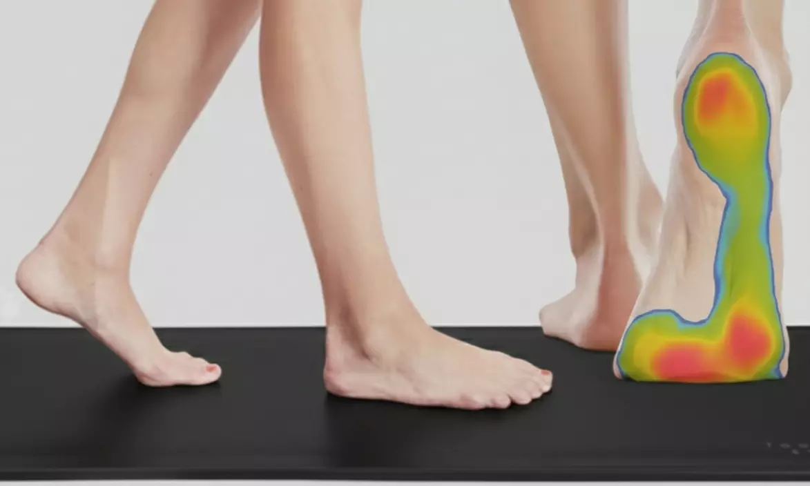 Digital Foot Pressure Scan & Biomechanical Assessment