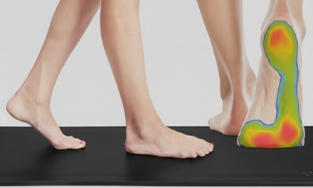 Digital Foot Presure Scan - 30 Minutes (+extra services) - Foot And Arch Ltd