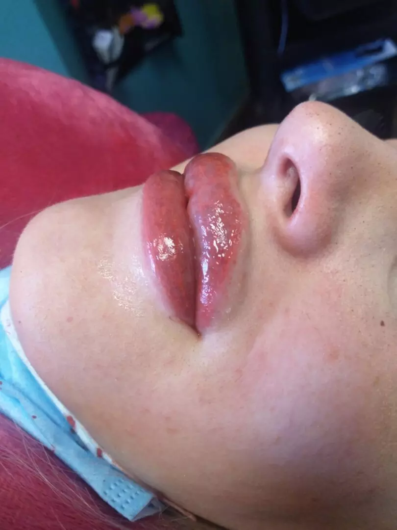 Discover Athena Beauty Bar's Lip Enhancements: Semi-Permanent Color Boosts and Unique Ombre Shading Up to 30% - Primary Image
