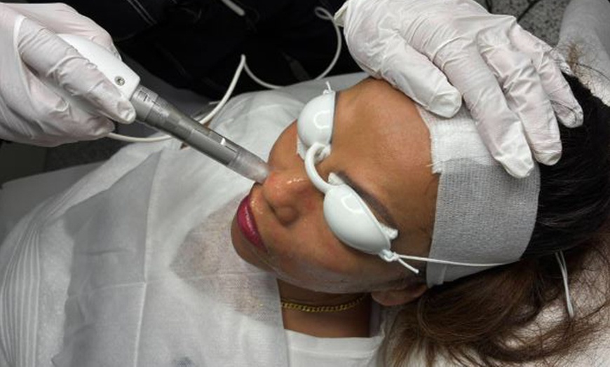 Image 1: 1 or 3 Sessions of RF Skin Tightening on Abdomen, Hips, Face & More 