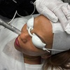 Image 1: 1 or 3 Sessions of RF Skin Tightening on Abdomen, Hips, Face & More 
