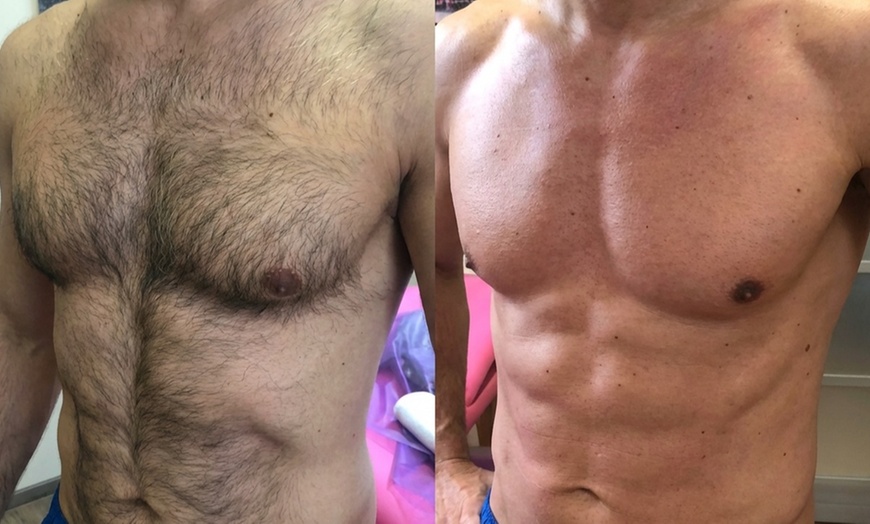 Image 4: Depilacja woskiem lub pastą cukrową wybranej partii ciała