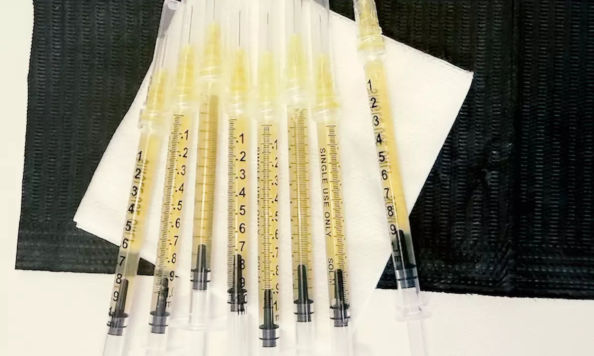 Transform Hair with One, Two, or Three PRP Hair Restoration Treatments
