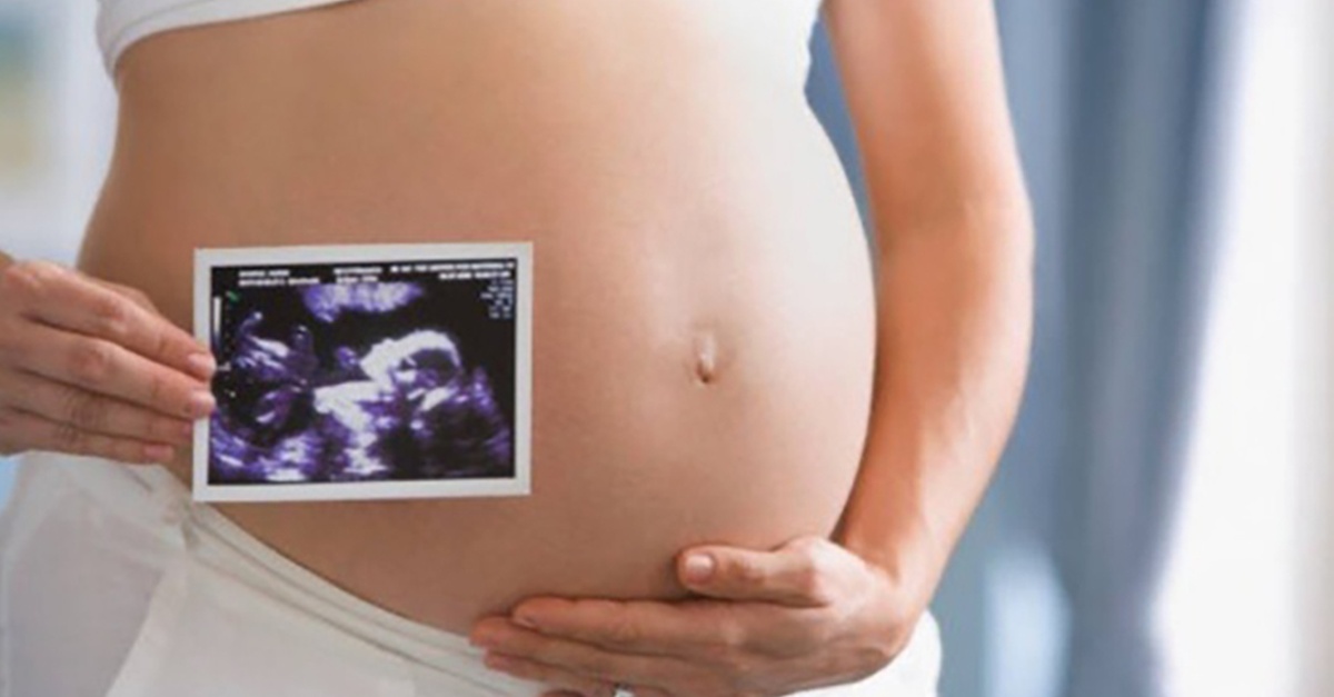 Up to 46% Off on Ultrasound - 3D / 4D at Miracle Ultrasound And Spa Llc