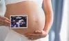 Experience First, Second, or Third Trimester Service For Gentle, Safe, and Soothing Care  (Up to 16% Off)