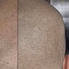 Image 4: Restore Confidence with Scalp Micropigmentation at Rose Beauty Bar