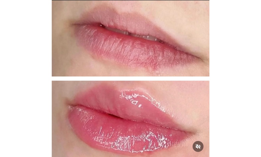 Image 5: Hydrating Lip Drip Treatment with/without Color Boost