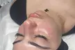 One, Two or Three Hydrafacial, Red Light Therapy and Much More at Intuitive Spa (Up to 62% Off) - Second Medium