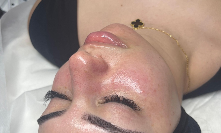 Image 5: One, Two or Three Hydrafacial, Red Light Therapy and Much More