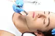 DiamondGlow Facial or Microdermabrasion and Light Peel Combo Treatment with Spa Bella Medispa (Up to 51% Off) - Second Medium