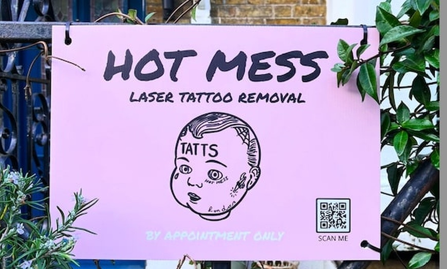 Image 1: Up to 60% Off on Tattoo Removal at Hot Mess