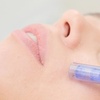 Image 2: 1 oder 2 Microneedling- oder Aqua-Facial-Behandlungen für 1 Person