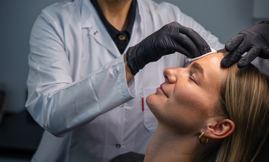 Image 2: Luxe Belotero Balance fillers met consultt voor een frisse uitstraling