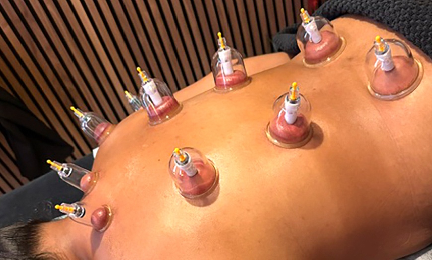 Image 15: Diepe ontspanning en balans met massage en cupping sessies