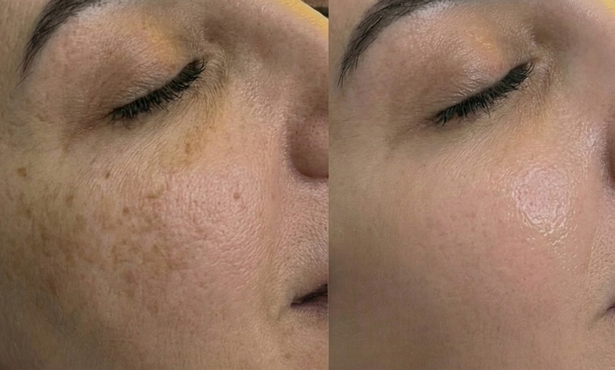 Image 19: Unifiez votre teint avec un soin anti-taches ciblé 5G Removal