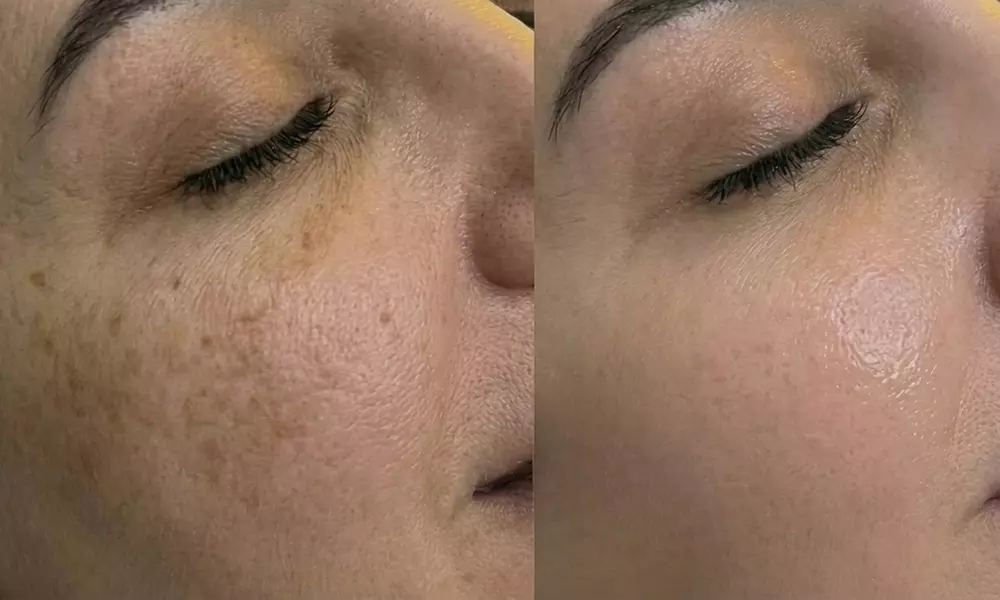 Unifiez votre teint avec un soin anti-taches ciblé 5G Removal