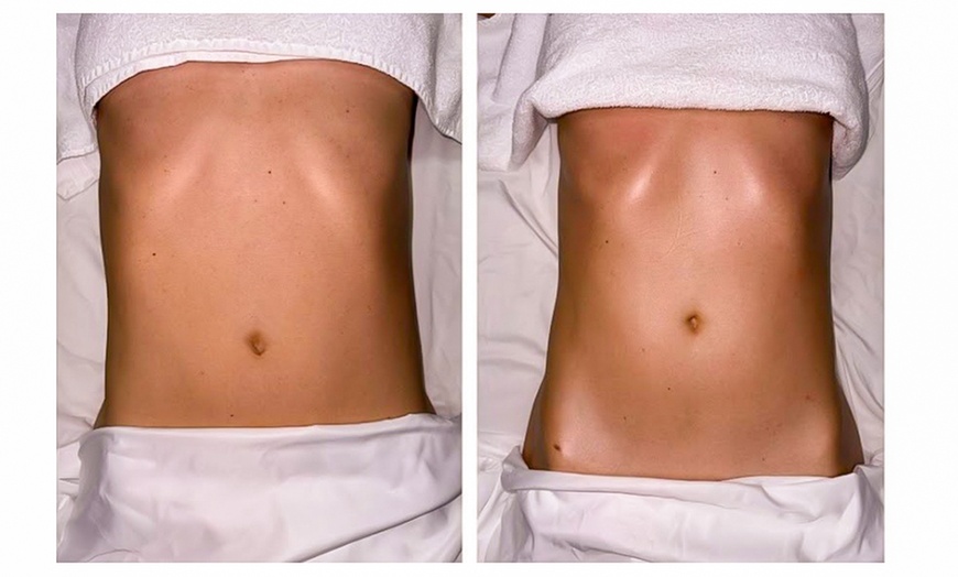 Image 3: One, Two or Three Cryo-Slimming Session for 1 Person (20 minutes)