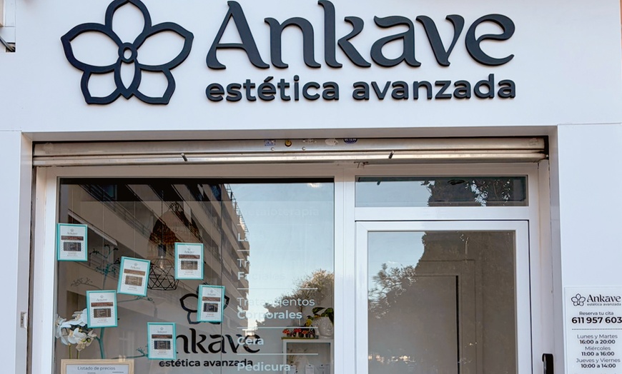 Image 15: Limpieza facial con tratamiento antiarrugas, hydralips, relleno y más