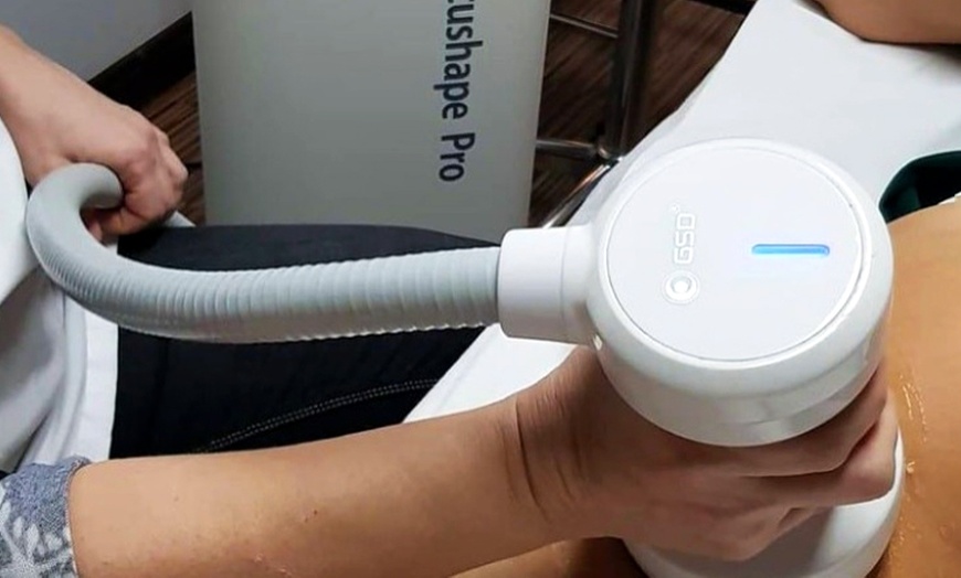 Image 3: 1 o 2 sesiones de liposucción sin cirugía con Focus Shape Pro