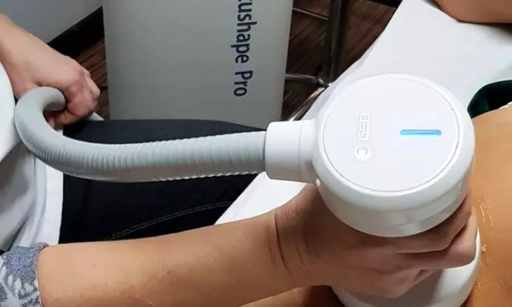 1 o 2 sesiones de liposucción sin cirugía con Focus Shape Pro