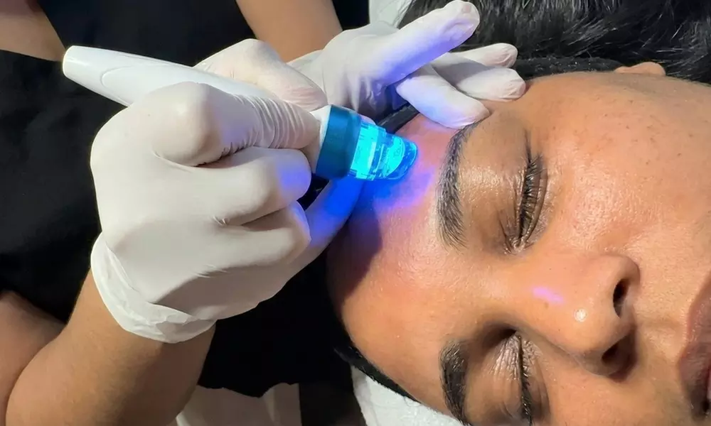 Experience a Refreshing HydraFacial for Radiant Skin