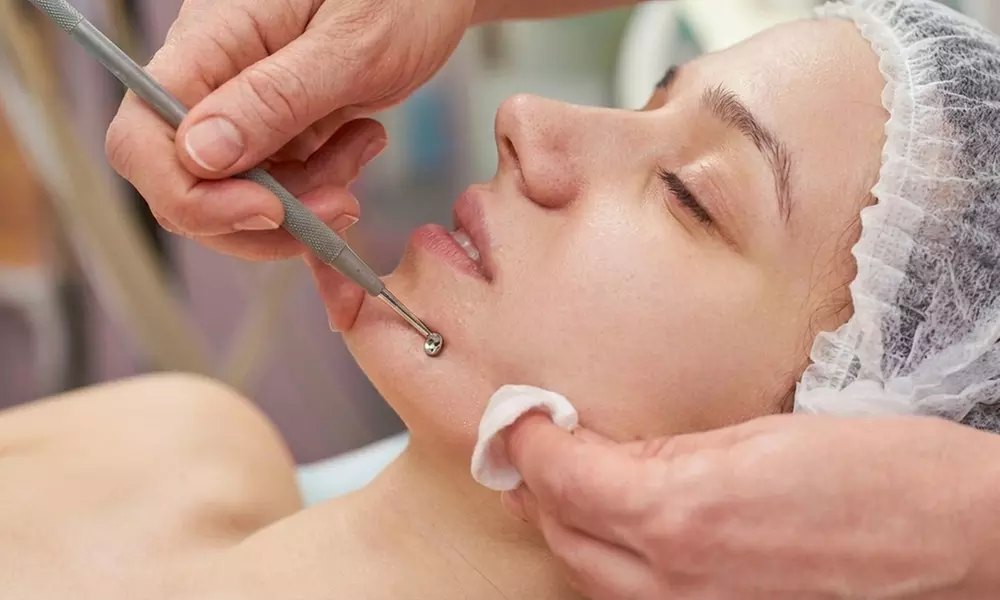 Limpieza facial profunda con opción a tratamiento específico