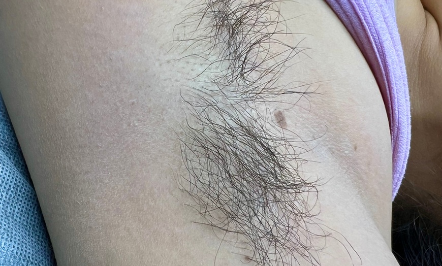Image 6: Brazilian and Underarm Waxing