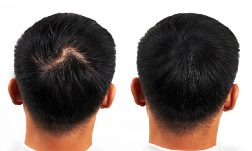 Image 19: Clone Beaver Hair Building Fibres and Beaver Fibre Hold Spray 