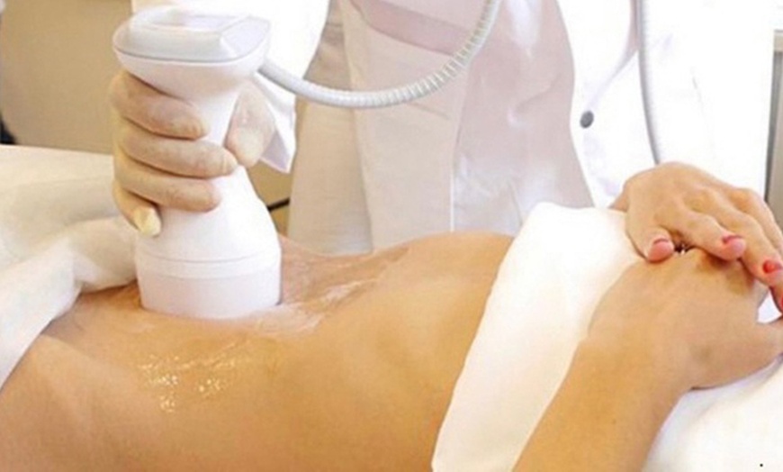 Image 2: 1 o 2 sesiones de liposucción sin cirugía con Focus Shape Pro