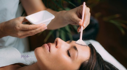 One 60-Minute Chemical Peel - McKallen Medical Wellness Center