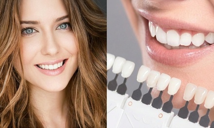 In-Office Laser Teeth Whitening and Teeth Cleaning Package - Butterfly Dental Care