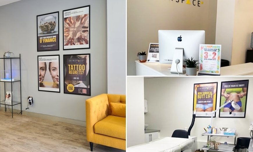 Image 2: Laser Tattoo Removal Session at SkinSpaceUK