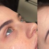 Image 3: One or Two Eyebrow Waxes with Optional Eyebrow Shaping & Lash Cluster