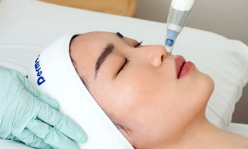 Image 3: Skin Needling, LED Therapy, Face Mask, Consultation, & More 