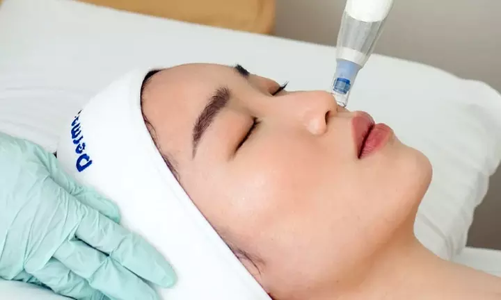 Skin Needling, LED Therapy, Face Mask, Consultation, & More