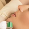Image 2: PRP for Hair, Skin, or Under-Eyes at Elume Medical Spa in Fairfax