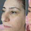 Image 2: Refresh Your Skin with One/Two HydraFacial