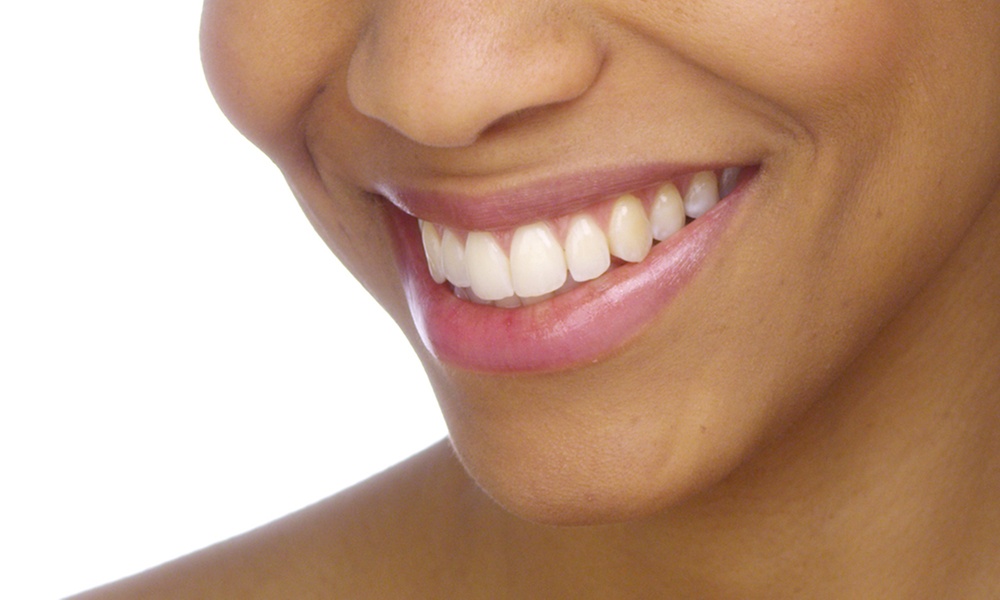 1 o 2 retenedores metálicos con limpieza bucal