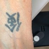 Image 1: 3 Laser Tattoo Removal Sessions: Small, Medium, Large or XL Areas