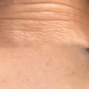 Image 4: Get a Youthful Glow with 20, 40, or 60 Units of Daxxify