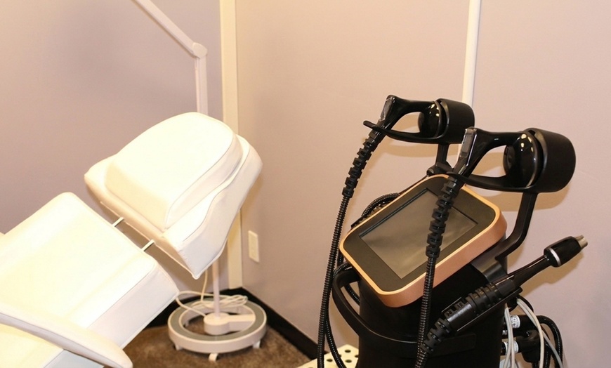 Image 4: 6 Splendor X Laser Hair Reduction Sessions for All Skin Types