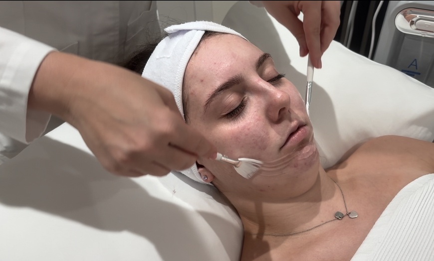 Image 8: Up to 57% Off on HydraFacial at Kolcheva Skin and Laser clinic