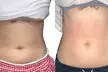 Transform Your Body with T-Shape 2 Body Contouring Intro Session at Blessed Beauty Boutique (Up to 56% Off) - Second Medium