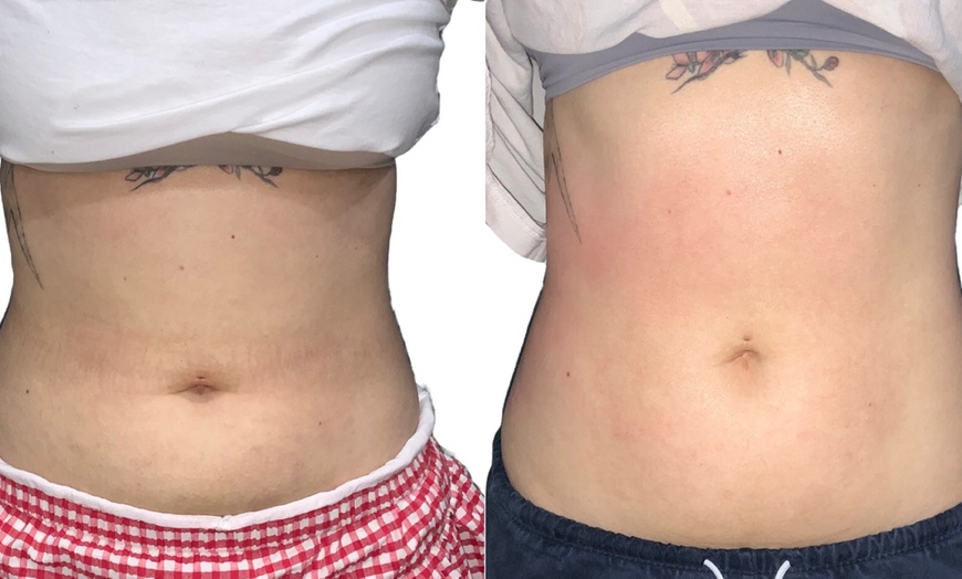 Image 3: Transform Your Body with T-Shape 2 Body Contouring Intro Session