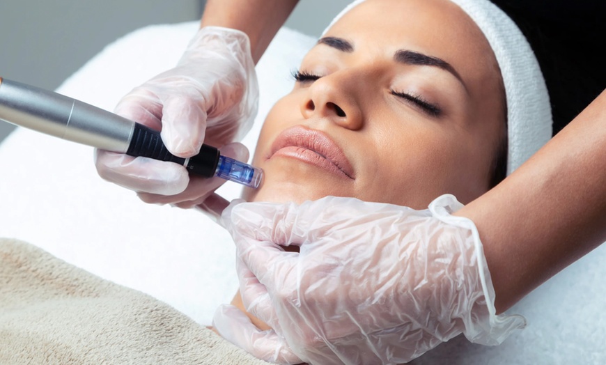 Image 1: Up to 59% Off on Vampire Facelift at Jade Vienna Aesthetics